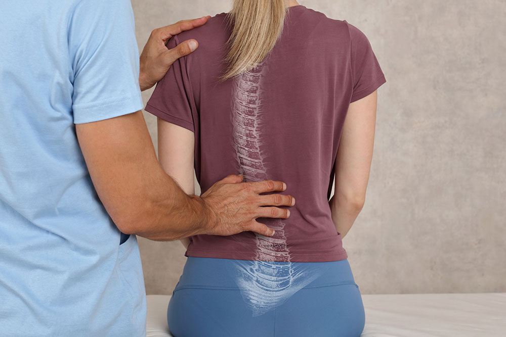 Scoliosis Spine Curve Anatomy, Posture Correction
